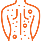 a rash and hives on a person's back